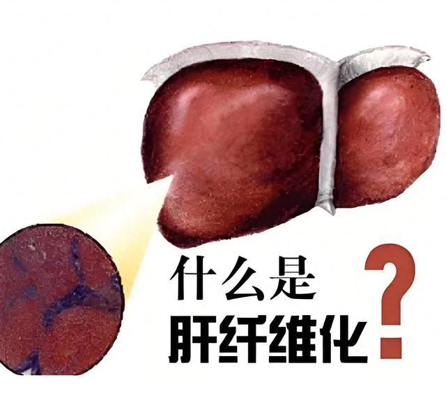 a45f96d3fc32cb91e8f4c71515628f7.jpg